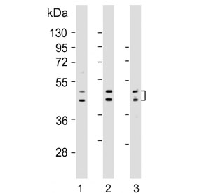 Western blot testing of human 1) HepG2, 2) LNCaP and 3) MDA-MB-453 cell lysate with UGT2B4 antibody. Predicted molecular weight: 43/46/61 kDa (three isoforms).