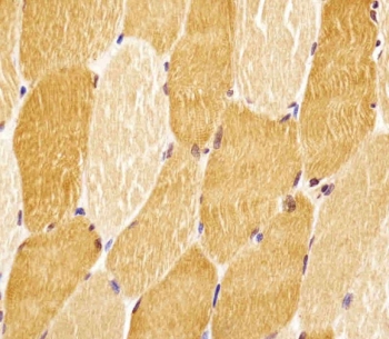 IHC testing of FFPE human skeletal muscle tissue with SLC29A2 antibody. HIER: steam section in pH6 citrate buffer for 20 min and allow to cool prior to staining.
