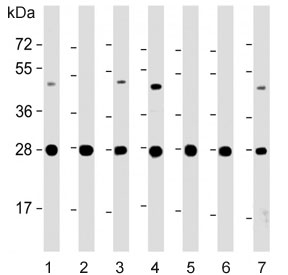 Western blot testing of human 1) HeLa, 2) Jurkat, 3) K562, 4) HepG2, 5) SH-SY5Y, 6) rat brain and 7) mouse brain lysate with HSD17B10 antibody. Predicted molecular weight ~27 kDa.