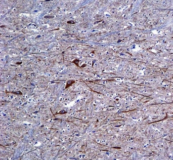IHC testing of FFPE human brain tissue with Neurofilament-66 antibody. HIER: steam section in pH6 citrate buffer for 20 min and allow to cool prior to staining.