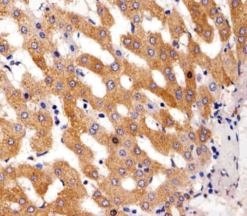 IHC testing of FFPE human liver tissue with Phenylalanine hydroxylase antibody. HIER: steam section in pH6 citrate buffer for 20 min and allow to cool prior to staining.