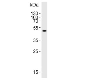 Western blot testing of human K562 cell lysate with ATG4A antibody. Predicted molecular weight ~45 kDa, commonly observed between 45-60 kDa.