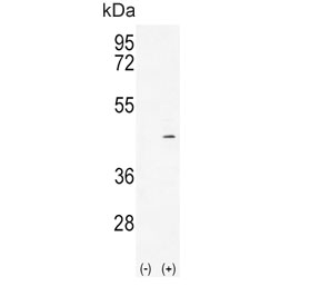 Western blot testing of 1) non-transfected and 2) transfected 293 cell lysate with Alcohol dehydrogenase 4 antibody. Predicted molecular weight ~40 kDa.