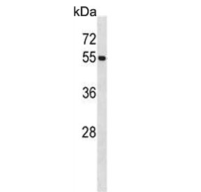 Western blot testing of human HL60 cell lysate with UBA3 antibody. Expected molecular weight ~52 kDa.