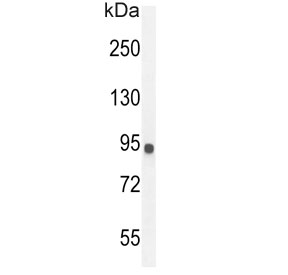 Western blot testing of human MDA-MB-435 cell lysate with IL12RB2 antibody. Predicted molecular weight ~97 kDa.