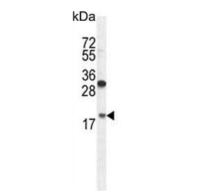 Western blot testing of hamster CHO cell lysate with RPL27A antibody. Predicted molecular weight ~17 kDa.