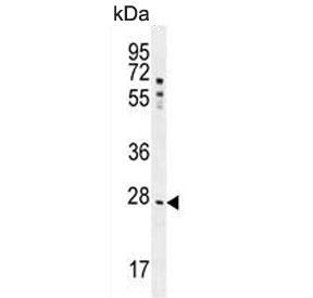 Western blot testing of human HepG2 cell lysate with NR0B2 antibody. Predicted molecular weight ~28 kDa.