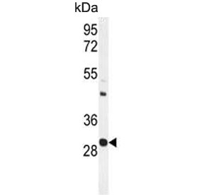 Western blot testing of mouse spleen tissue lysate with Upstream stimulatory factor 1 antibody. Predicted molecular weight ~28/34 kDa (two isoforms).