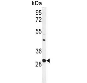 Western blot testing of mouse spleen tissue lysate with Upstream stimulatory factor 1 antibody. Predicted molecular weight ~28 kDa.