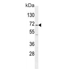 Western blot testing of human Jurkat cell lysate with GAD2 antibody. Predicted molecular weight ~65 kDa.