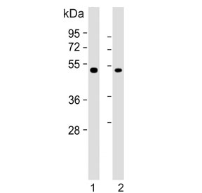 Western blot testing of human 1) A549 and 2) SK-BR-3 cell lysate with Inhibin beta B chain antibody. Expected molecular weight: 17 kDa (mature form), 42 kDa (pro peptide form) and 55 kDa (pro form).