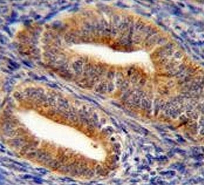 IHC testing of FFPE human uterus tissue with Dipeptidyl peptidase 3 antibody. HIER: steam section in pH6 citrate buffer for 20 min and allow to cool prior to staining.