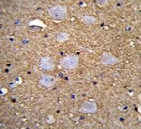 IHC testing of FFPE human brain tissue with CAMSAP1 antibody. HIER: steam section in pH6 citrate buffer for 20 min and allow to cool prior to staining.