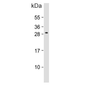 Western blot testing of human MOLT4 cell lysate with ALKBH6 antibody. Predicted molecular weight ~26 kDa.