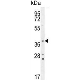 Western blot testing of mouse lung lysate with Twinfilin 2 antibody. Predicted molecular weight ~39 kDa.
