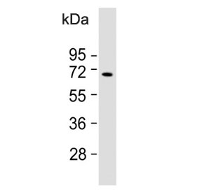 Western blot testing of human Ramos cell lysate with KNG1 antibody. Predicted molecular weight ~72 kDa.