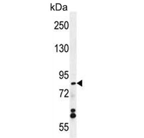 Western blot testing of human MCF7 cell lysate with WDR27 antibody. Predicted molecular weight ~90 kDa.