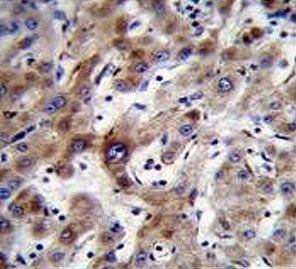 IHC testing of FFPE human liver tissue with ADP,ATP carrier protein 3 antibody. HIER: steam section in pH6 citrate buffer for 20 min and allow to cool prior to staining.