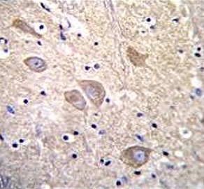 IHC testing of FFPE human brain tissue with VSNL1 antibody. HIER: steam section in pH6 citrate buffer for 20 min and allow to cool prior to staining.