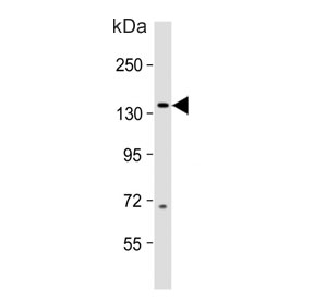 Western blot testing of human fetal brain lysate with MAP3K15 antibody. Predicted molecular weight ~147 kDa.