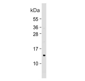 Western blot testing of human HepG2 cell lysate with COX7A2L antibody. Predicted molecular weight ~13 kDa.