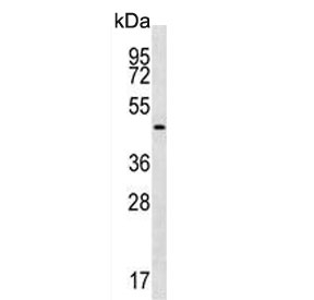 Western blot testing of human K562 cell lysate with Gastric Intrinsic Factor antibody. Predicted molecular weight ~45 kDa.