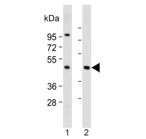 Western blot testing of human 1) HepG2 and 2) skeletal muscle lysate with ASAM antibody. Predicted molecular weight ~41 kDa.