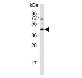 Western blot testing of human lung lysate with Bcl-G antibody. Predicted molecular weight ~37 kDa.