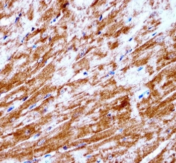 IHC testing of FFPE mouse heart tissue with Pyruvate dehydrogenase kinase 2 antibody. HIER: steam section in pH6 citrate buffer for 20 min and allow to cool prior to staining.