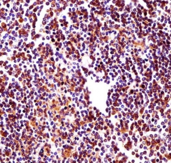 IHC testing of FFPE human spleen tissue with RBM22 antibody. HIER: steam section in pH6 citrate buffer for 20 min and allow to cool prior to staining.