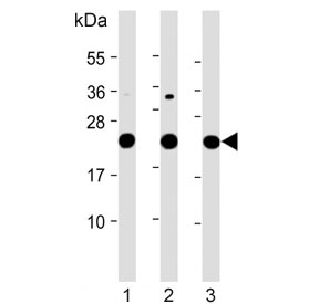 Western blot testing of 1) human HeLa, 2) human K562 and 3) rat PC-12 cell lysate with LZIC antibody. Predicted molecular weight ~21 kDa.