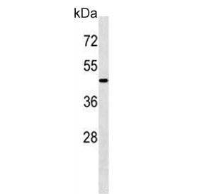 Western blot testing of mouse kidney tissue lysate with ATG4A antibody. Predicted molecular weight ~45 kDa, commonly observed between 45-60 kDa.