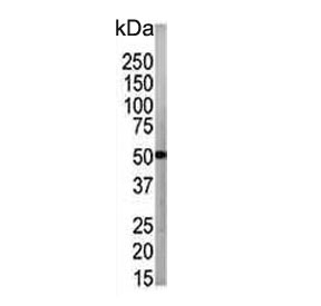 Western blot testing of human CCRF-CEM cell lysate with ATG4B antibody. Expected molecular weight: 37-52 kDa (multiple isoforms).