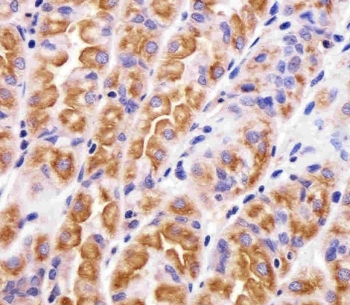 IHC testing of FFPE human stomach tissue with VAMP-8 antibody. HIER: steam section in pH6 citrate buffer for 20 min and allow to cool prior to staining.