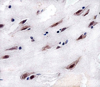 IHC testing of FFPE human brain tissue with CSNK2A1 antibody. HIER: steam section in pH6 citrate buffer for 20 min and allow to cool prior to staining.