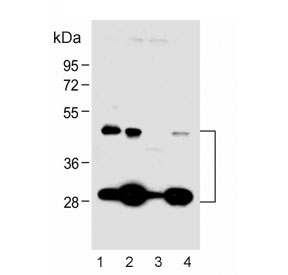 Western blot testing of human 1) A431, 2) MCF7, 3) K562 and 4) PANC-1 cell lysate with Cathepsin D antibody. Expected molecular weight: 43-46 kDa, 28 kDa (heavy chain), 15 kDa (light chain).