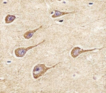 IHC testing of FFPE human brain tissue with NPY2R antibody. HIER: steam section in pH6 citrate buffer for 20 min and allow to cool prior to staining.