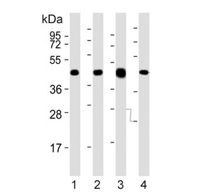 Western blot testing of mouse 1) brain, 2) liver, 3) heart and 4) testis tissue lysate with Utf1 antibody. Predicted molecular weight: 36 kDa, commonly observed molecular weight: 36-48 kDa.