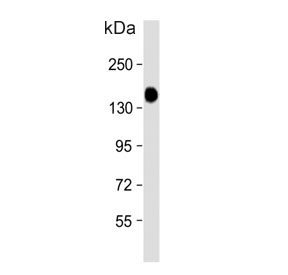 Western blot testing of human skeletal muscle tissue lysate with Glycogen debranching enzyme antibody. Predicted molecular weight ~175 kDa.