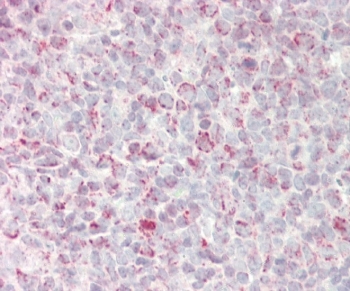 IHC testing of FFPE human tonsil tissue with GADD45A antibody. HIER: steam section in pH6 citrate buffer for 20 min and allow to cool prior to staining.