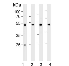 Western blot testing of 1) human Jurkat, 2) human MCF7, 3) human U-251 and 4) mouse brain lysate with Alpha Enolase antibody. Predicted molecular weight ~47 kDa.