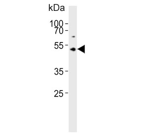 Western blot testing of human Y79 cell lysate with ASMT antibody. Predicted molecular weight ~38 kDa.