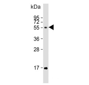 Western blot testing of human HeLa cell lysate with FUT6 antibody. Predicted molecular weight ~42 kDa, but may be observed at higher molecular weights due to glycosylation.