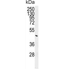 Western blot testing of human K562 cell lysate with G6PC antibody. Predicted molecular weight ~41 kDa.