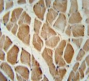 IHC testing of FFPE human skeletal muscle tissue with DAAM1 antibody. HIER: steam section in pH6 citrate buffer for 20 min and allow to cool prior to staining.