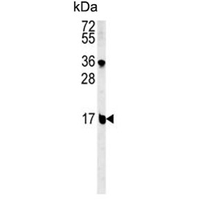 Western blot testing of mouse NIH 3T3 cell lysate with BLOC1S2 antibody. Predicted molecular weight ~16 kDa.
