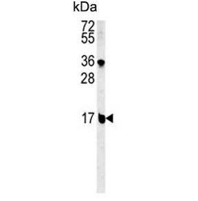 Western blot testing of mouse NIH 3T3 cell lysate with BLOC1S2 antibody. Predicted molecular weight ~16 kDa.