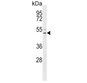 Western blot testing of human NCI-H292 cell lysate with S1PR4 antibody. Predicted molecular weight ~42 kDa.