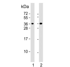 Western blot testing of human 1) HeLa and 2) Jurkat cell lysate with CLNS1A antibody. Predicted molecular weight ~26 kDa but may be observed at up to ~43 kDa.