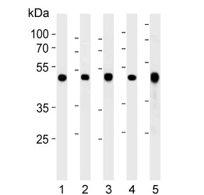 Western blot testing of 1) human Jurkat, 2) human MCF7, 3) human U-251, 4) mouse NIH 3T3 and 5) mouse brain lysate with ENO1 antibody. Predicted molecular weight ~47 kDa.